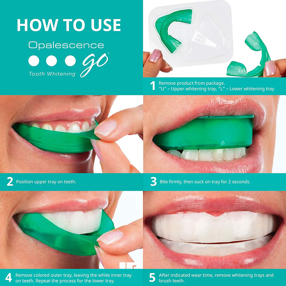 Perossido di idrogeno per sbia - Teeth Whitening Kit recensione e prezzo