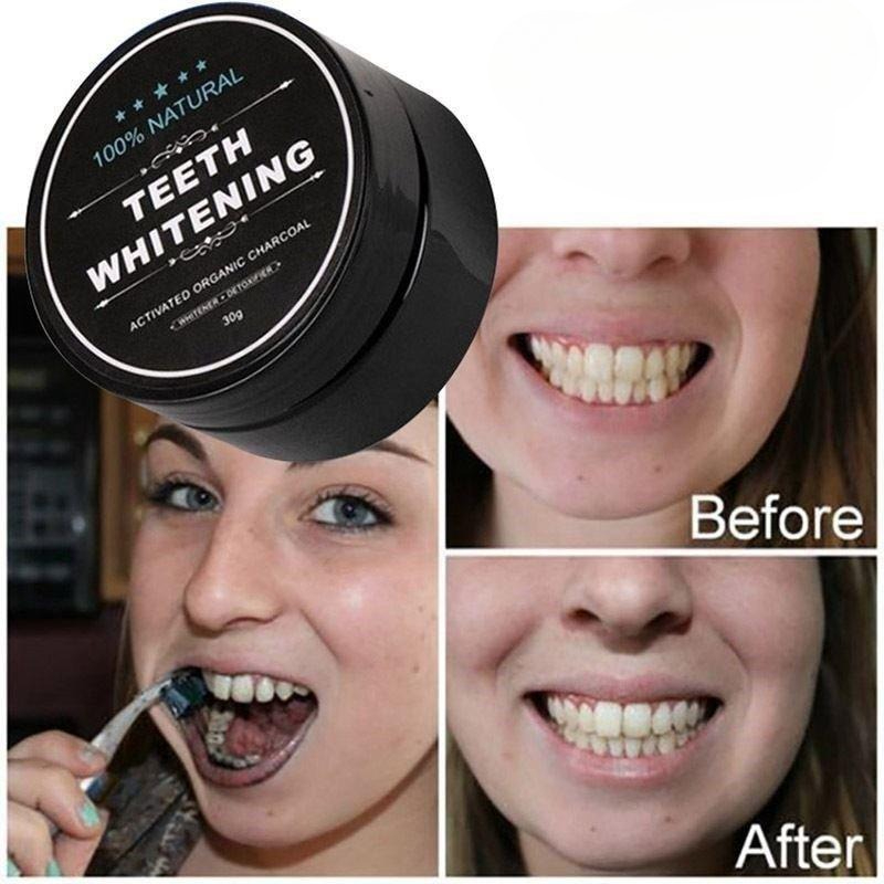 1 scatola di polvere per sbian - Teeth Whitening Pens recensione e prezzo